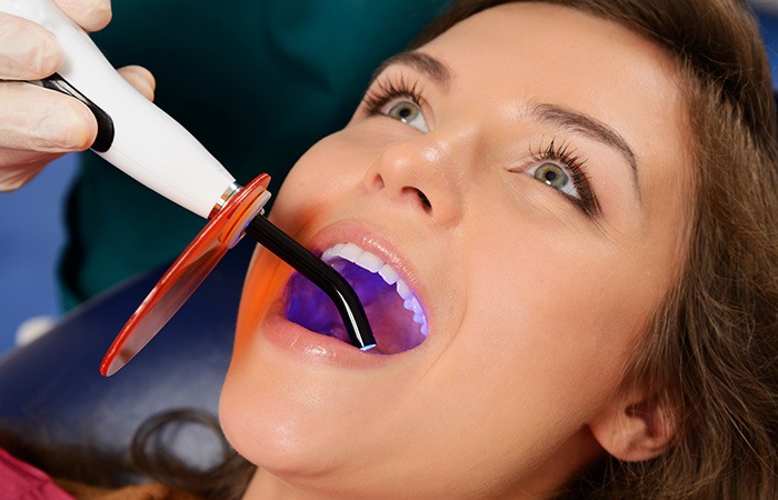 Woman receiving tooth-colored fillings in Studio City